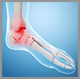 Advance treatment for Foot and Ankle Pain for Seniors