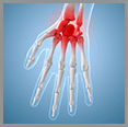 Treatment Options for Common Afflictions of the Hand