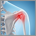 Total Shoulder Replacement Surgery Preparation Class