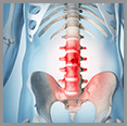 Is Minimally Invasive Spine Surgery an Option for you?