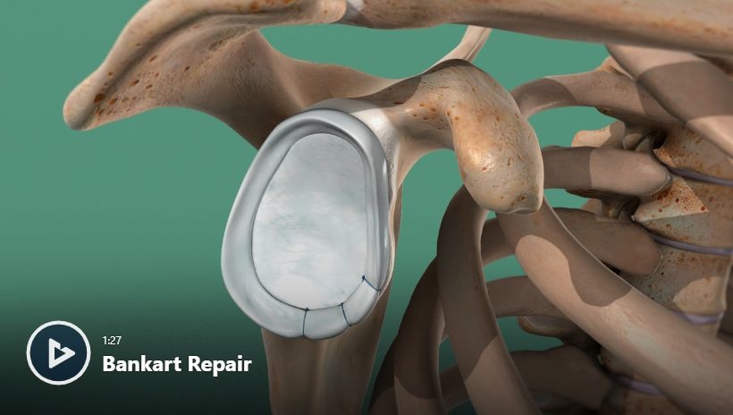 Shoulder Conditions & Treatments | Orthopedic Services Newport Beach, CA