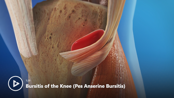 Knee Conditions & Treatments | Newport Orthopedic Institute