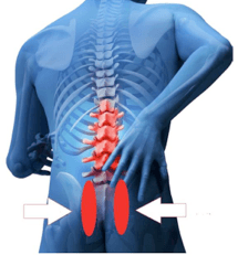 x-ray image of back pain